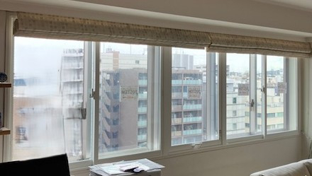 イチロのLIXILインプラス　３時間施工の施工後の写真1