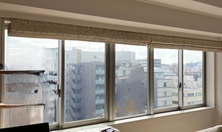 イチロのLIXILインプラス　３時間施工の施工前の写真1