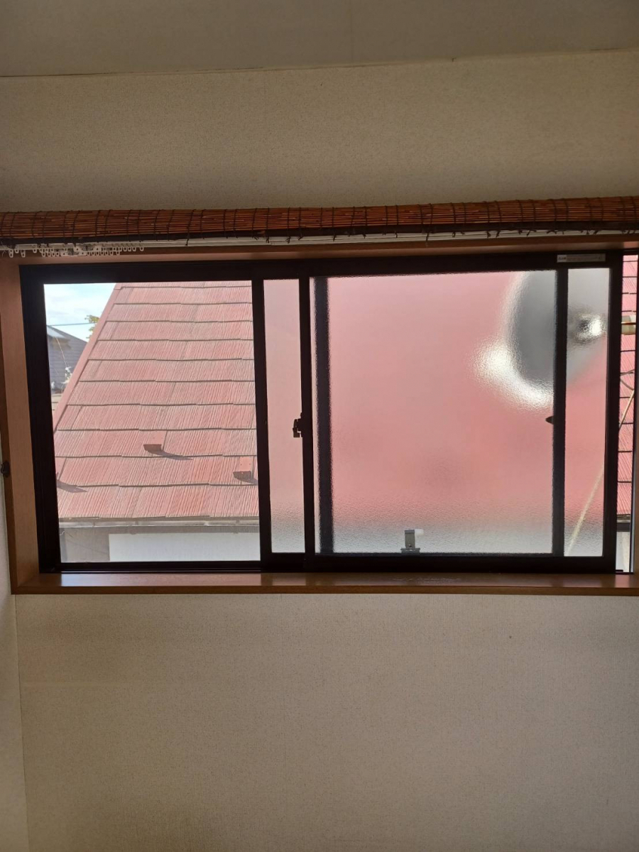 城南ケンソーの【世田谷区】インプラス施工事例の施工前の写真3